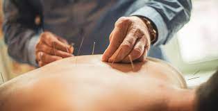 What Are Acupuncture‘s Health Advantages?